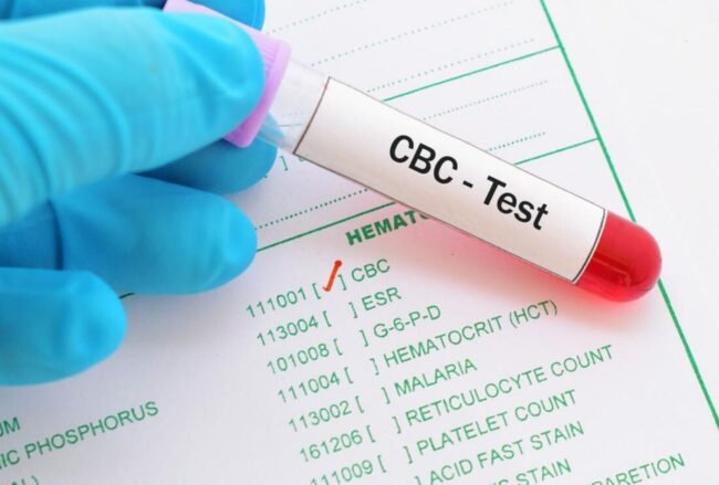 complete-blood-picture-cbc-test-cost-in-hyderabad